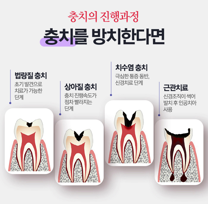 강남역 스케일링 일년에 한두번은 치과에서 관련 이미지 11