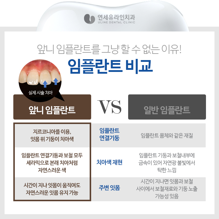 앞니임플란트가격 좋은예후를 기대하러 관련 이미지 7