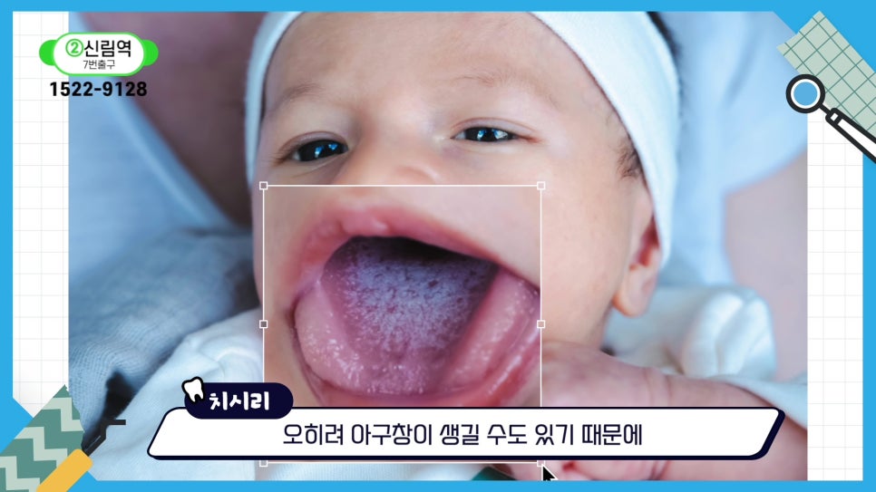신림동치과 - 아기 양치는 언제부터? 관련 이미지 4
