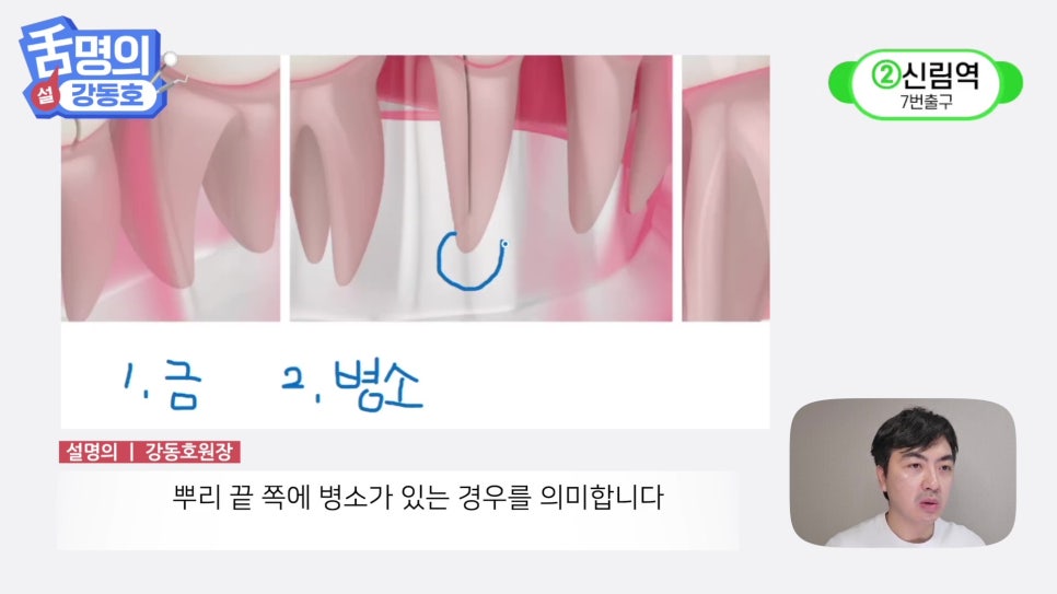 Sillim Station Dentist - Why Does It Hurt When Chewing? image 6