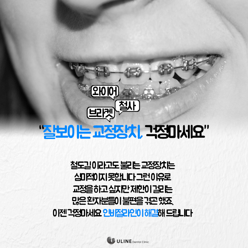 인비절라인 인증치과 니까 믿을 수 있지 관련 이미지 7
