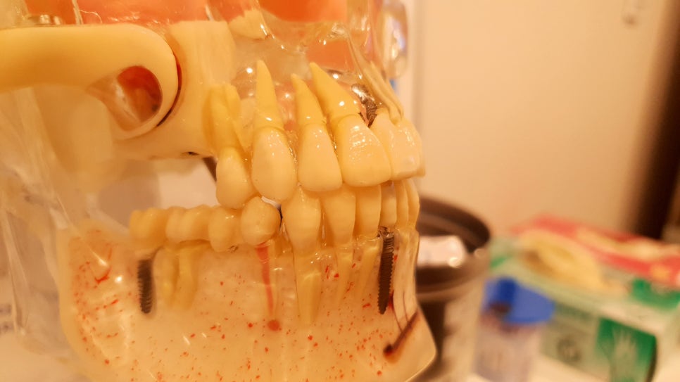신도림치과 여러분의 선택은 무엇인가요 관련 이미지 3