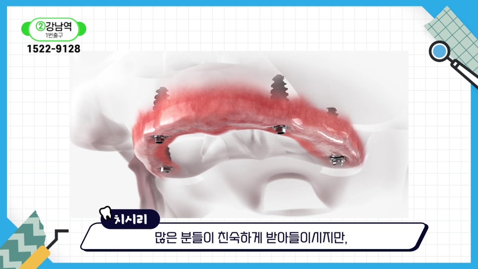 Sillim-dong Dentist — If You Want to Keep Your Natural Teeth for Life image 14