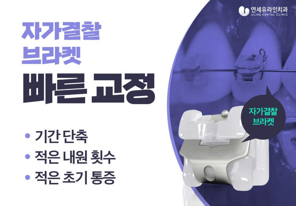 클리피씨교정기간 이렇게나 단축되다니! 관련 이미지 4