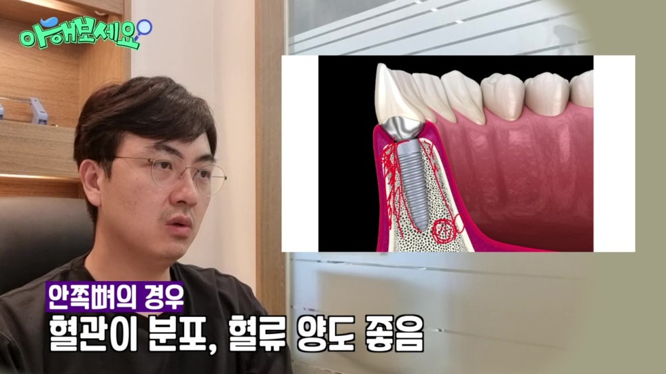 역삼역임플란트치과, 젊은층도 실패를? 관련 이미지 15