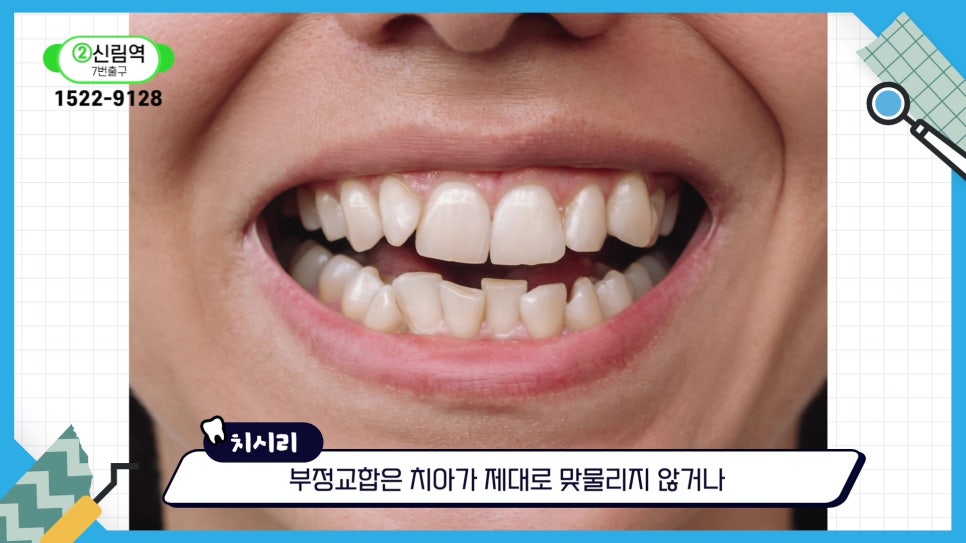 신림치아교정 - 부정교합, 나쁜 ㅇㅇ 때문? 관련 이미지 4