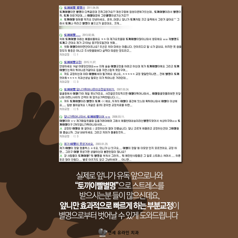 벌어진앞니교정 콤플렉스 빠이! 관련 이미지 7