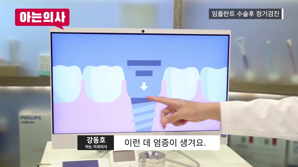 신림역임플란트 후, 정기검진 안 하면 관련 이미지 14