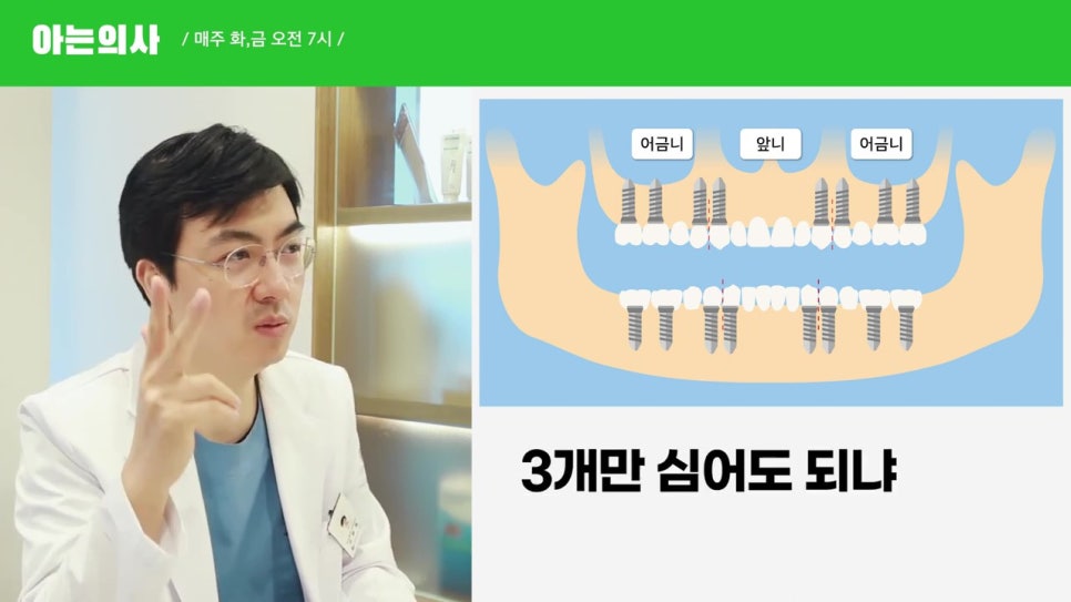 관악구임플란트, 최소 몇개? 관련 이미지 11