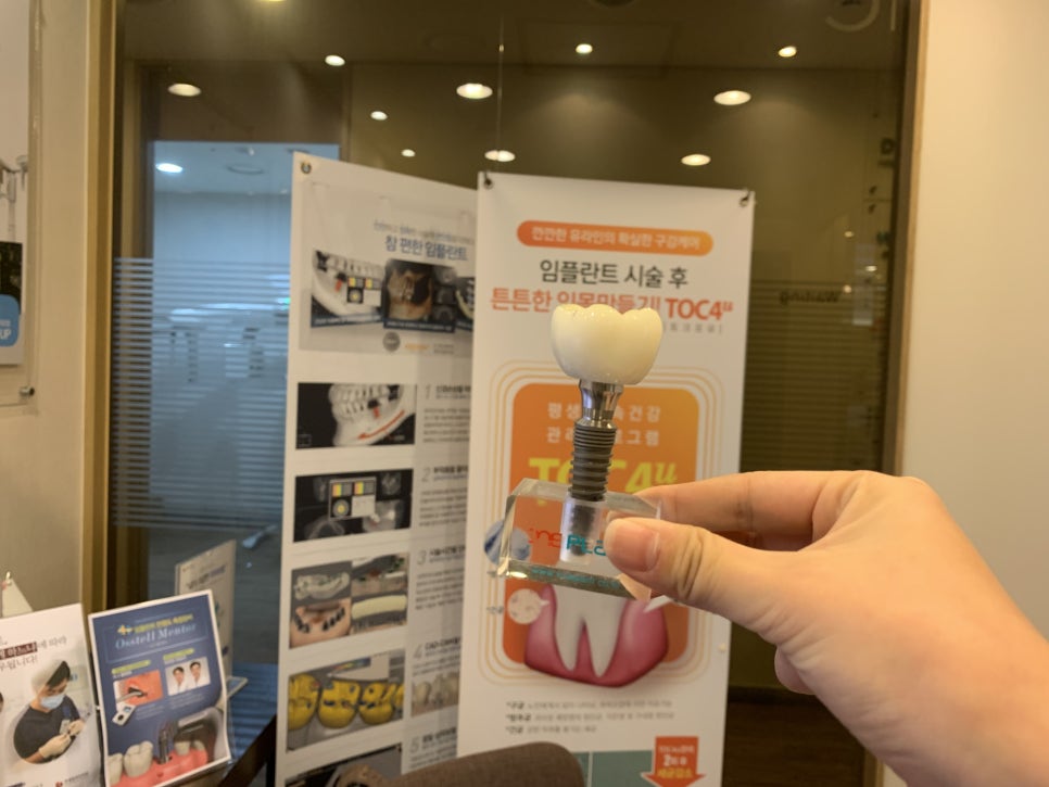 어금니임플란트가격 안전하게 접근하기 관련 이미지 2