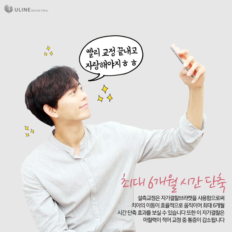 설측교정후기 반해버릴껄! 관련 이미지 4
