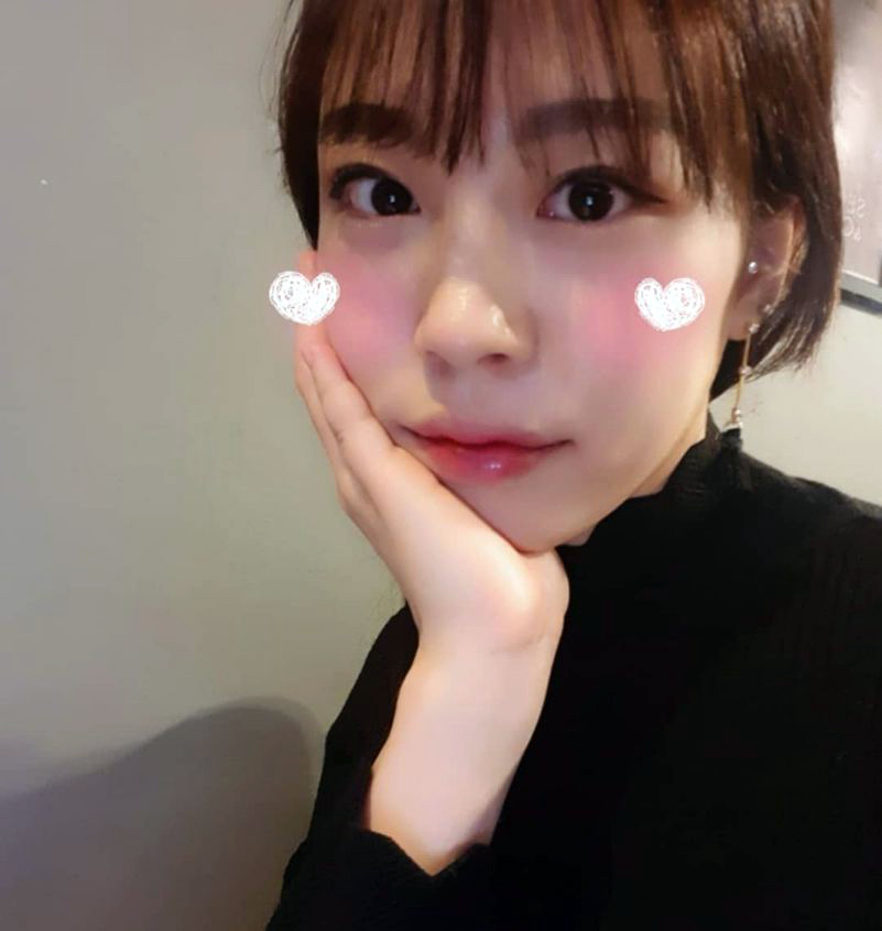 앞니부분교정가격 후기 들으면 하고싶을껄 관련 이미지 1