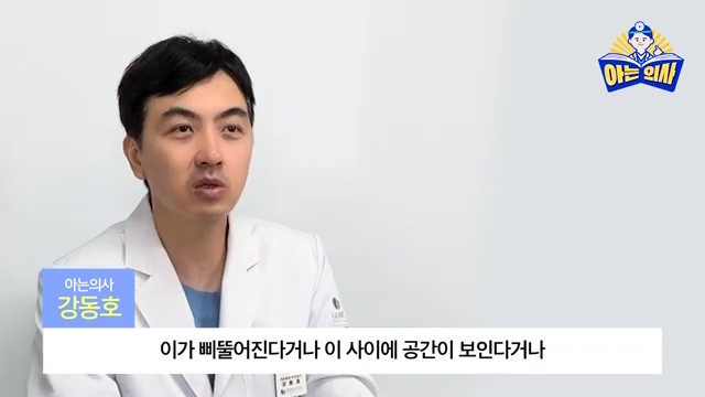 라미네이트, 하루만에 완성? 관련 이미지 24