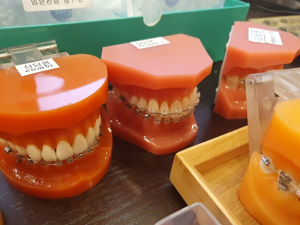 역삼역 스케일링 후 잇몸피는 자연스러워 관련 이미지 2