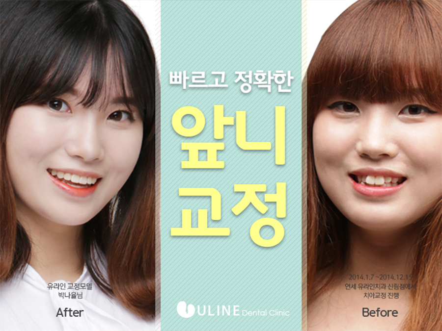 학동역치과 후회없이 관련 이미지 5