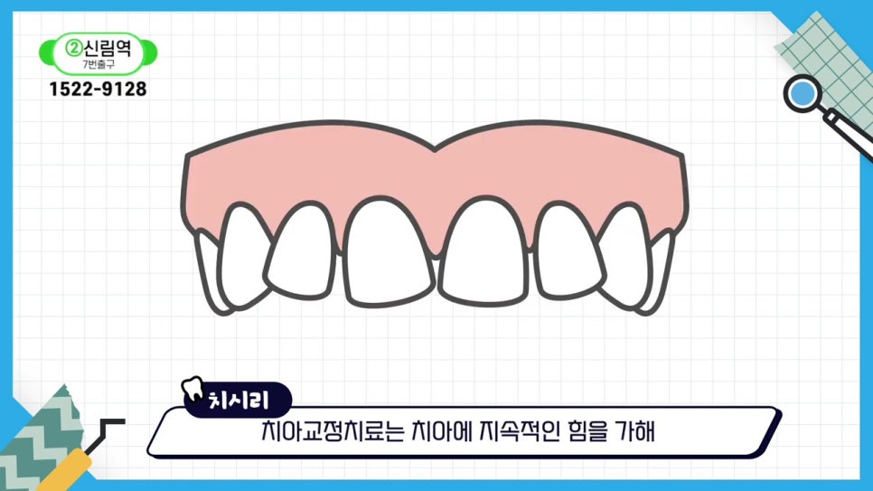 관악구치아교정, 빨리 끝내고 싶어? 관련 이미지 5