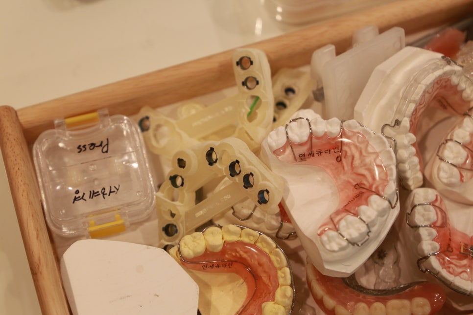 설측교정후기 생활에 지장없이 관련 이미지 4