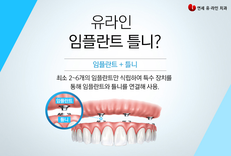 임플란트틀니가격 건강하고 행복하기 위해 관련 이미지 3