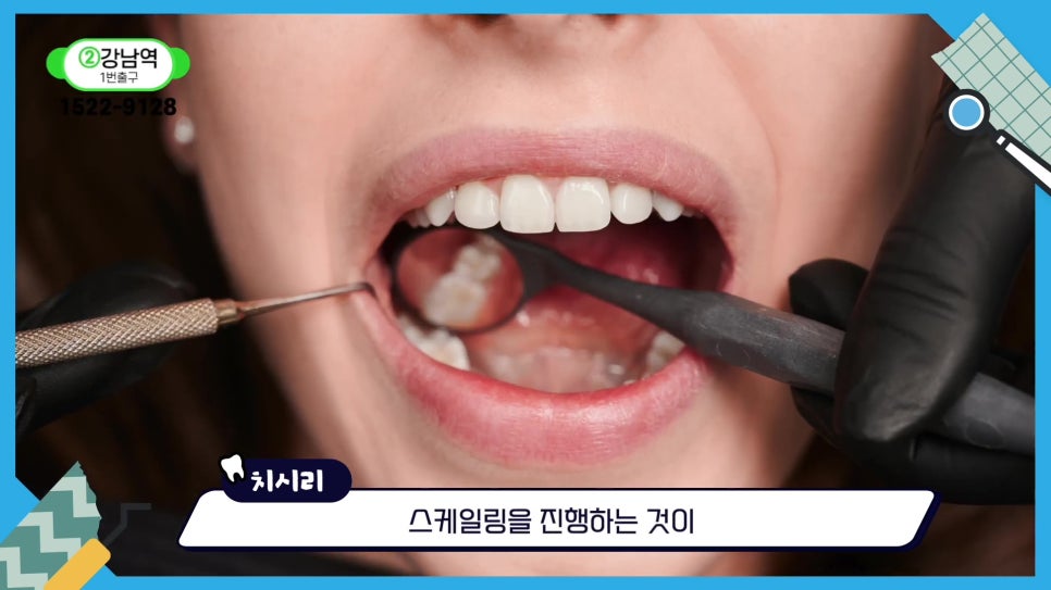 Sillim-dong Dentist — If You Want to Keep Your Natural Teeth for Life image 20