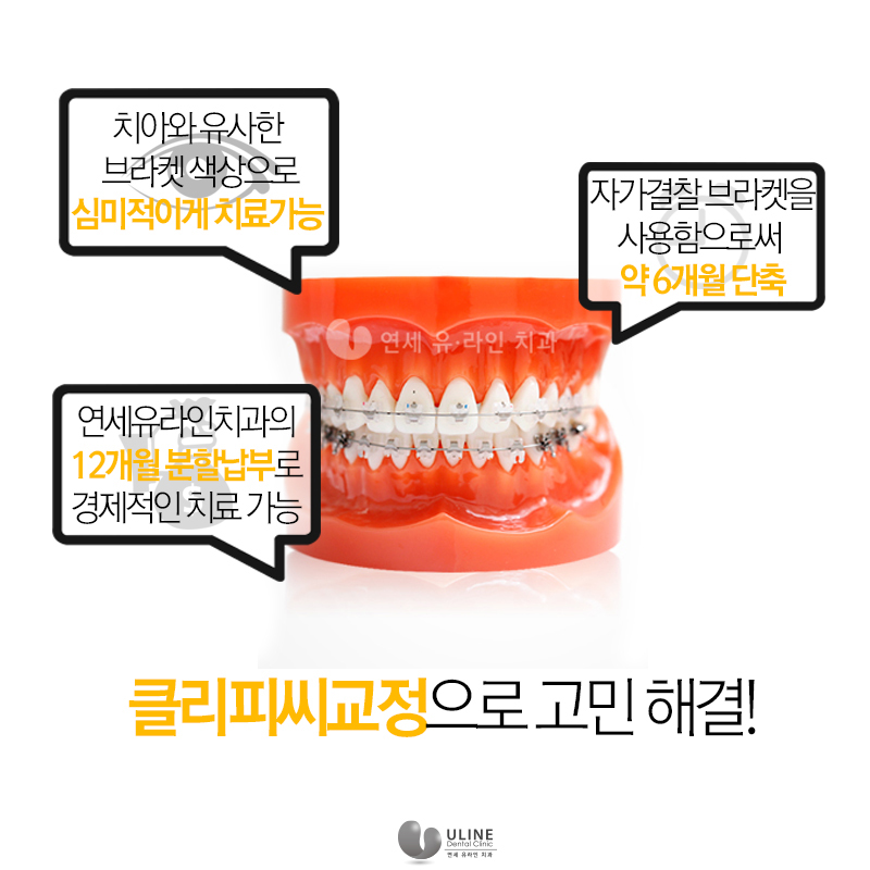 성인치아교정 고민하고계신가요? 관련 이미지 7