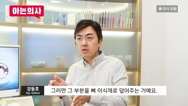 임플란트, 뼈이식 꼭 해야하는 케이스는? 관련 이미지 29