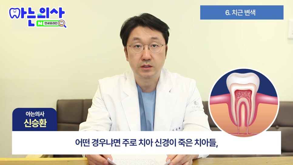가락시장역치과 - 잇몸 왜 까매질까 관련 이미지 18