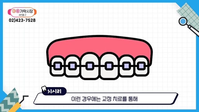 Can the Gaps Between Your Teeth That Make You Look Older Be Fixed? image 14