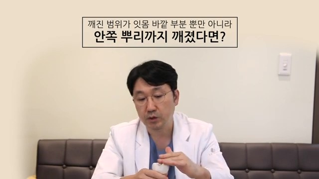 치아 부러짐, 파절엔 임플란트가 답? 관련 이미지 26
