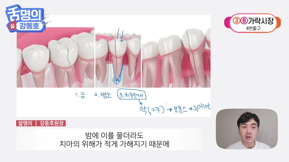 역삼역야간진료치과, 씹을 때마다 아파? 관련 이미지 42