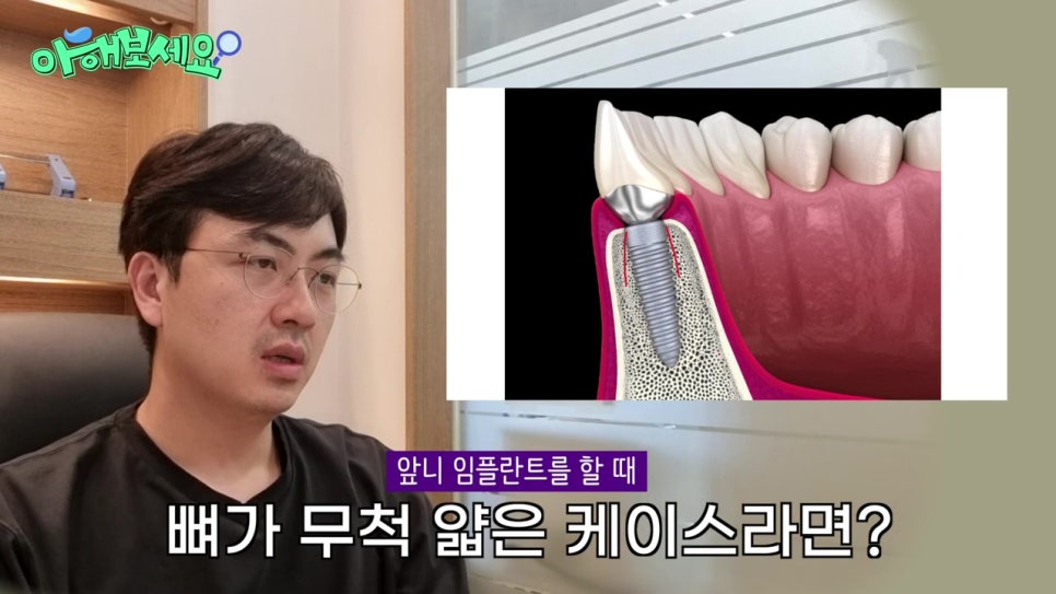 역삼역임플란트치과, 젊은층도 실패를? 관련 이미지 17