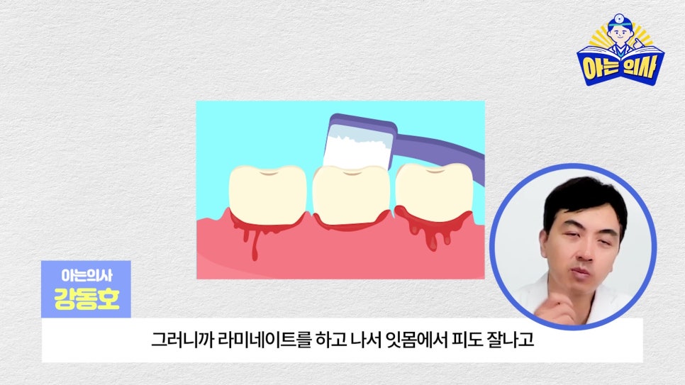 무삭제라미네이트, 단점 알고해야 관련 이미지 15