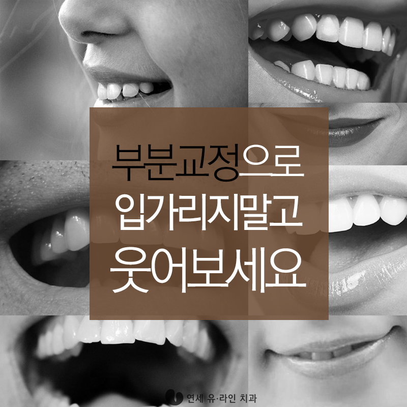 돌출앞니부분교정 탈출 후기 궁그맹! 관련 이미지 5