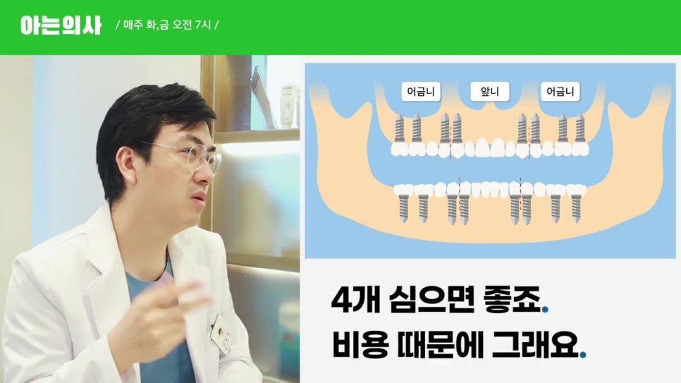 관악구임플란트, 최소 몇개? 관련 이미지 12