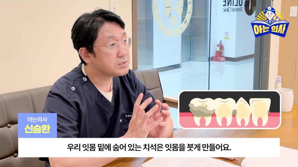 송파구치과 - 잇몸치료와 스케일링 차이는? 관련 이미지 23