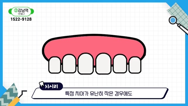 Can the Gaps Between Your Teeth That Make You Look Older Be Fixed? image 17