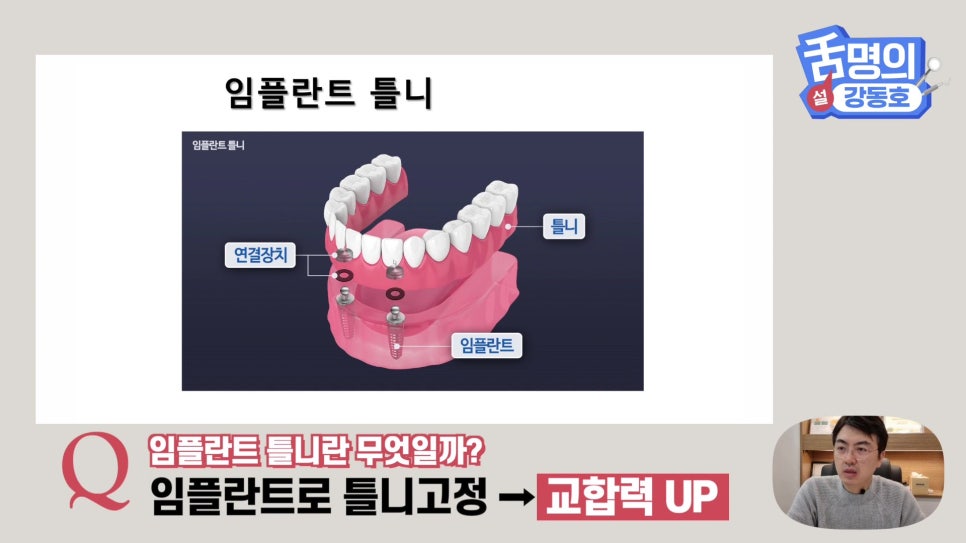 Dental Implants at Sillim Station: When There Is Not Enough Jawbone image 14