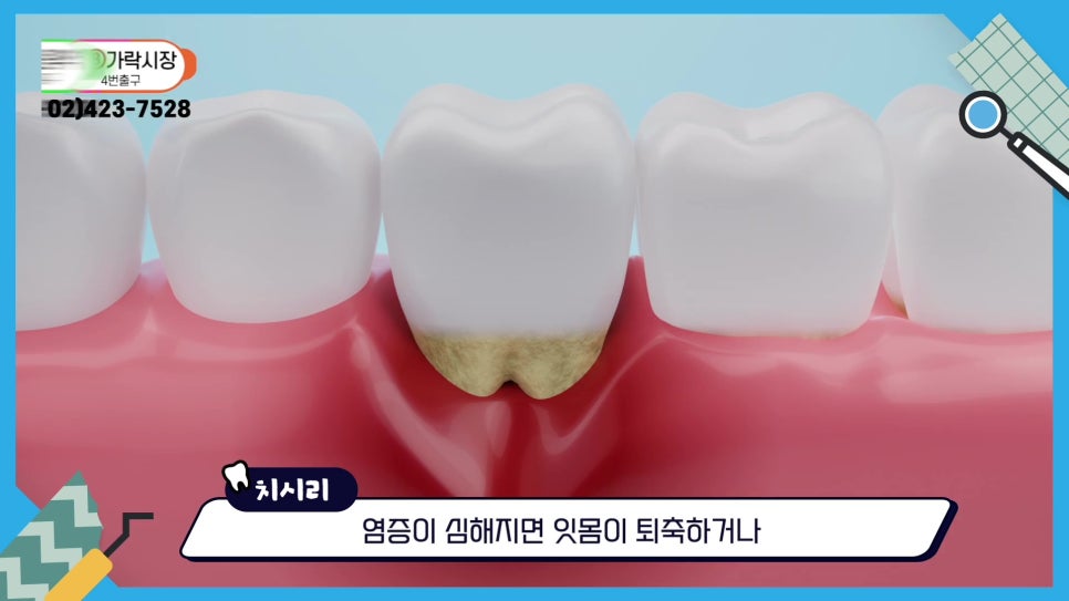 Gum Health During Orthodontic Treatment in Sillim-dong.. image 12