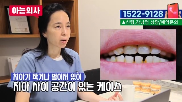 라미네이트가 유리한 케이스는? 관련 이미지 7