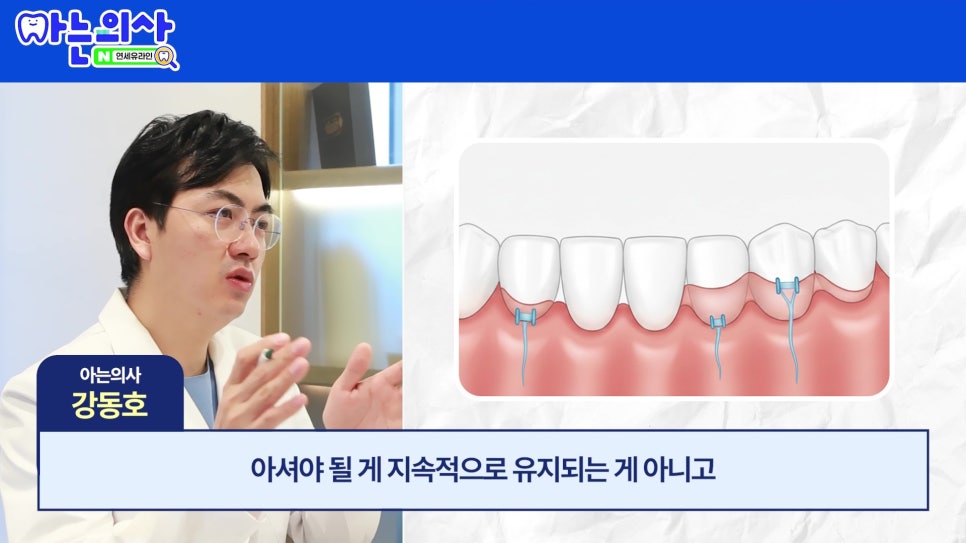 관악구 신림동치과 - 치아가 길어보이는 이유 관련 이미지 27