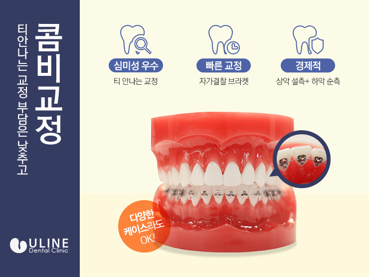 신림동치과 예쁜치아 만들기 시작 관련 이미지 3