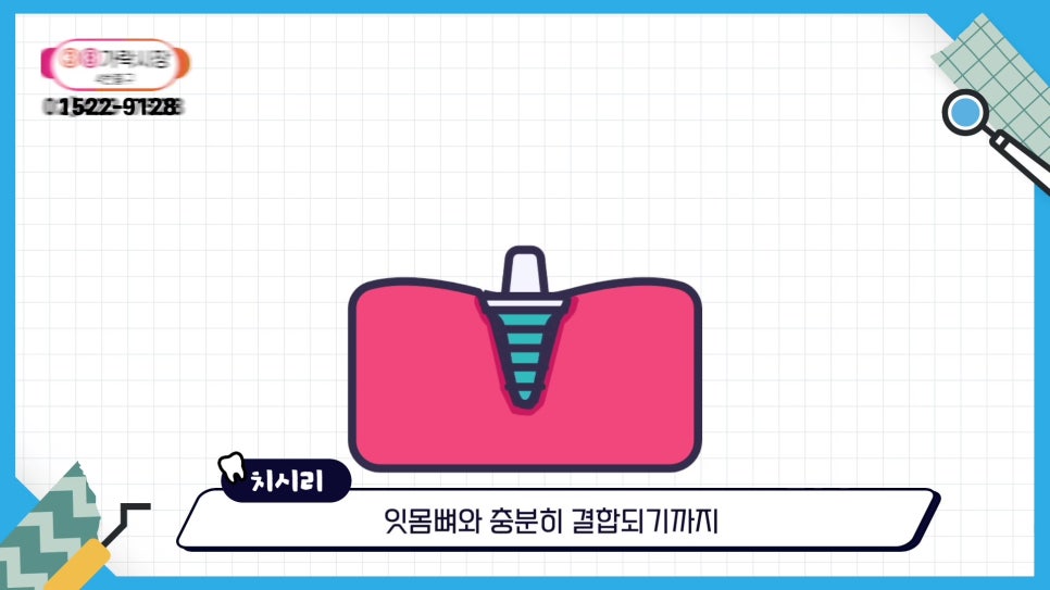 Sillim-dong Dental Clinic – Dentures vs. Implants: Which Should You Choose? image 18