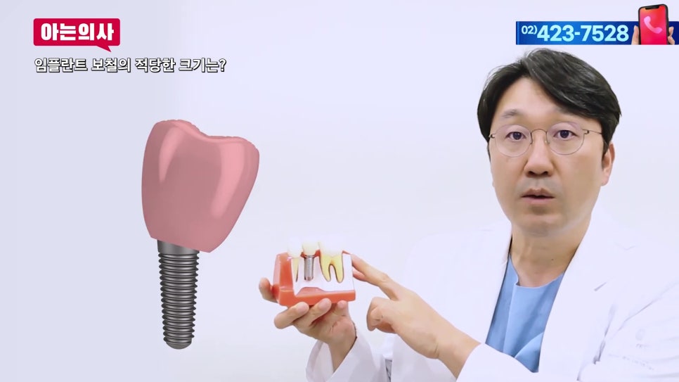임플란트, 내 치아보다 작은 이유는 관련 이미지 3
