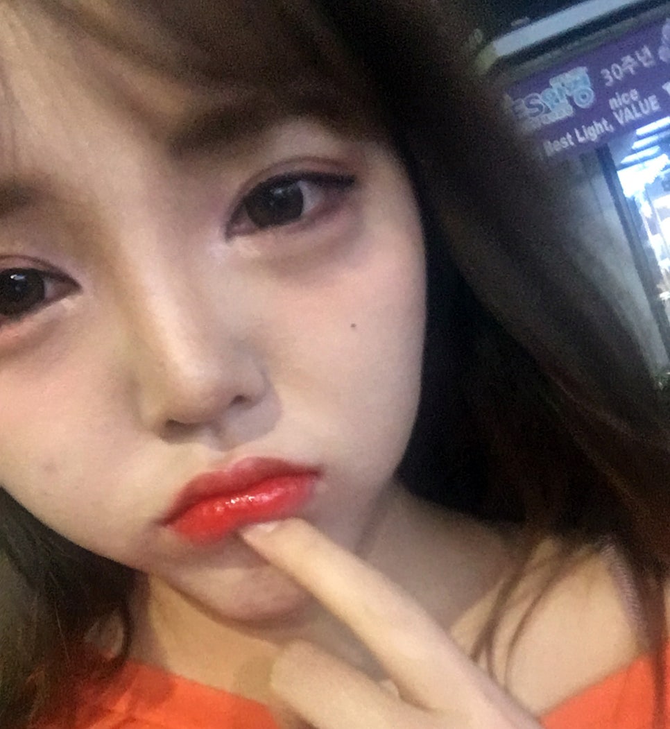 토끼앞니교정 치열로 생긴 별명 싫어! 관련 이미지 1