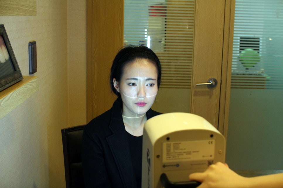 앞니부분교정가격 후기 들으면 하고싶을껄 관련 이미지 3