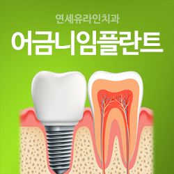 어금니임플란트가격 오랜 기간 사용 원하신다면 관련 이미지 1