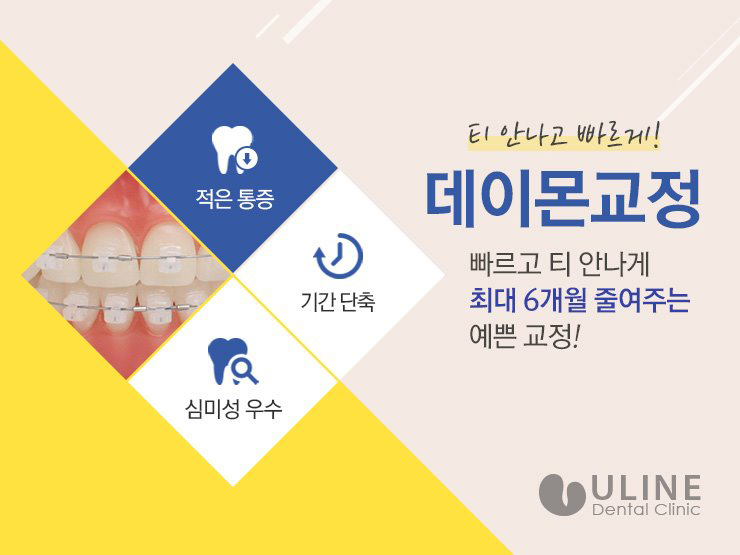종합운동장역치과 정확한 결과가 중요하죠 관련 이미지 8