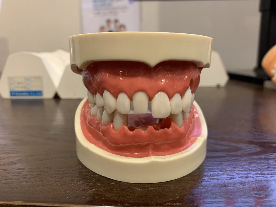 가락동치과 마무리까지 좋아야죠 관련 이미지 1