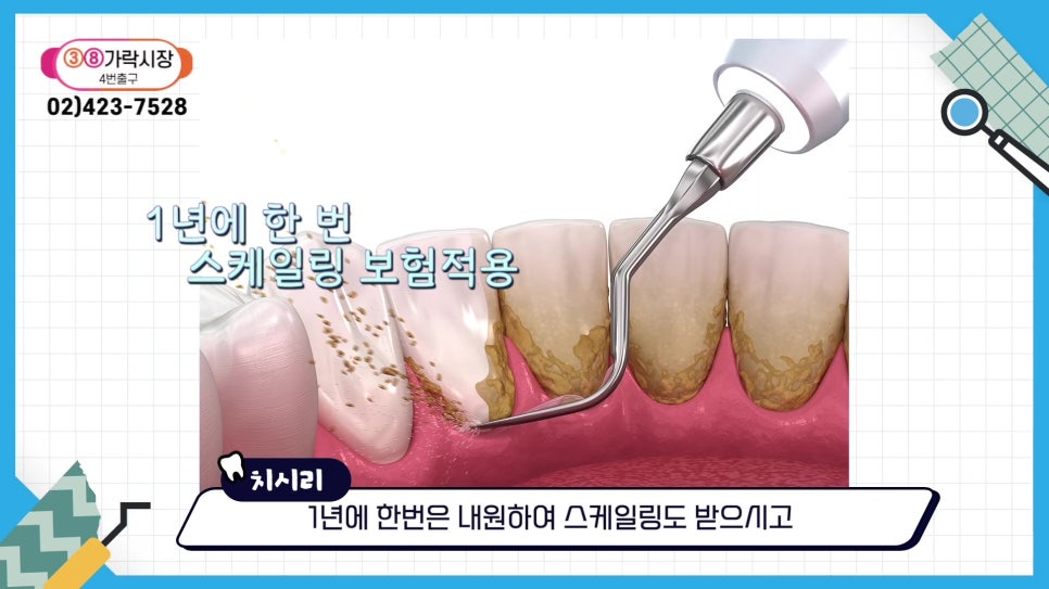 신림역치과 - 치아 균열은 자연 회복되지 않아 관련 이미지 13