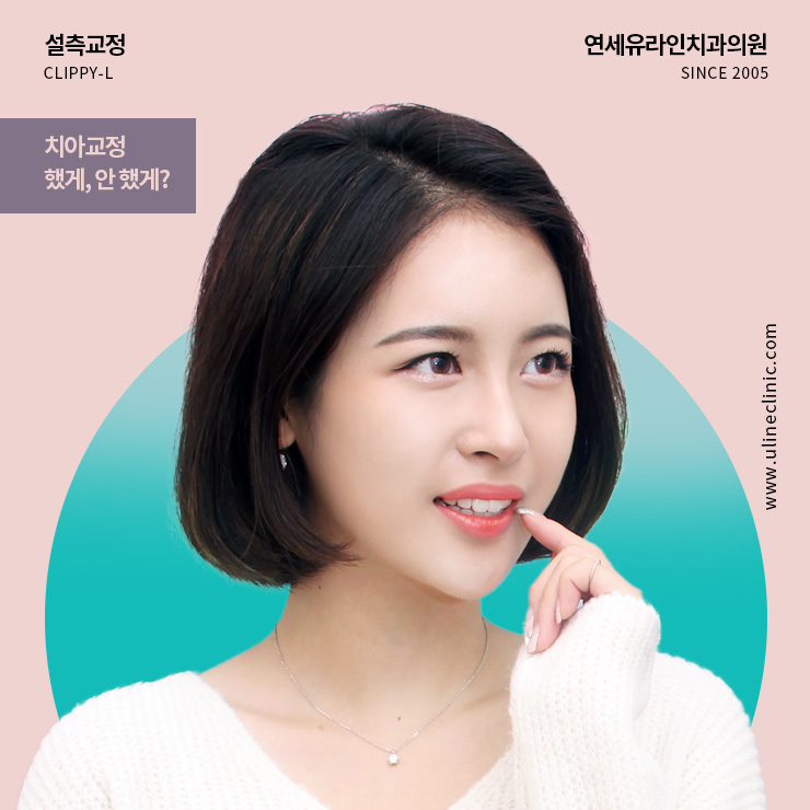 설측교정기간 내꺼하자! 관련 이미지 1