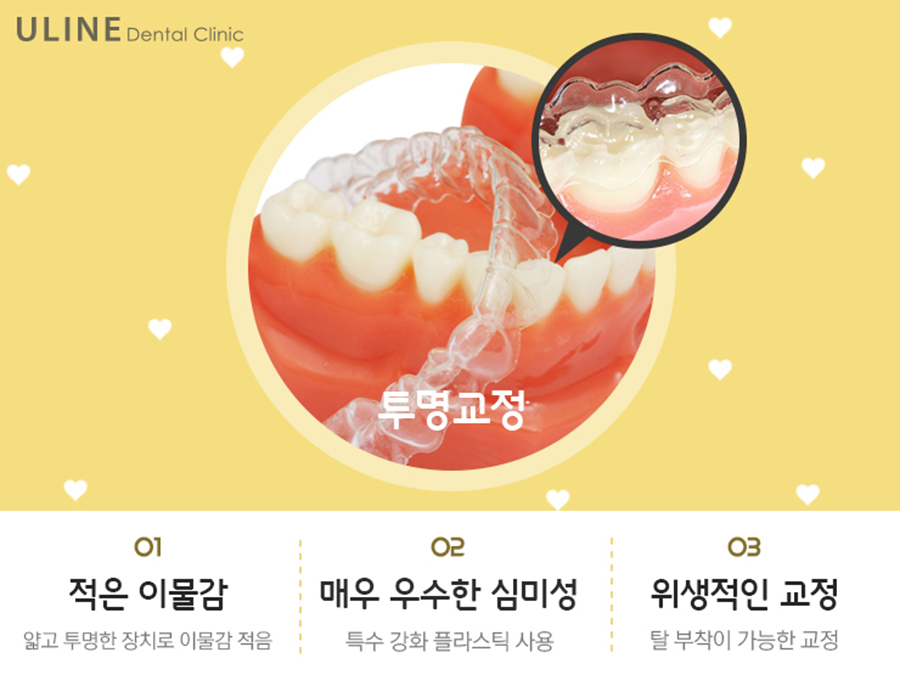 신림역치과 교정은 역시 관련 이미지 3